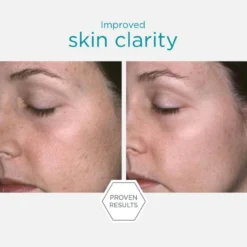 Neostrata Restore Facial Cleanser - 200ml 8 Neostrata Restore Facial Cleanser - 200ml -Boutique Beauté et Cosmétiques Champagne Bronze 7 41061.1653998535