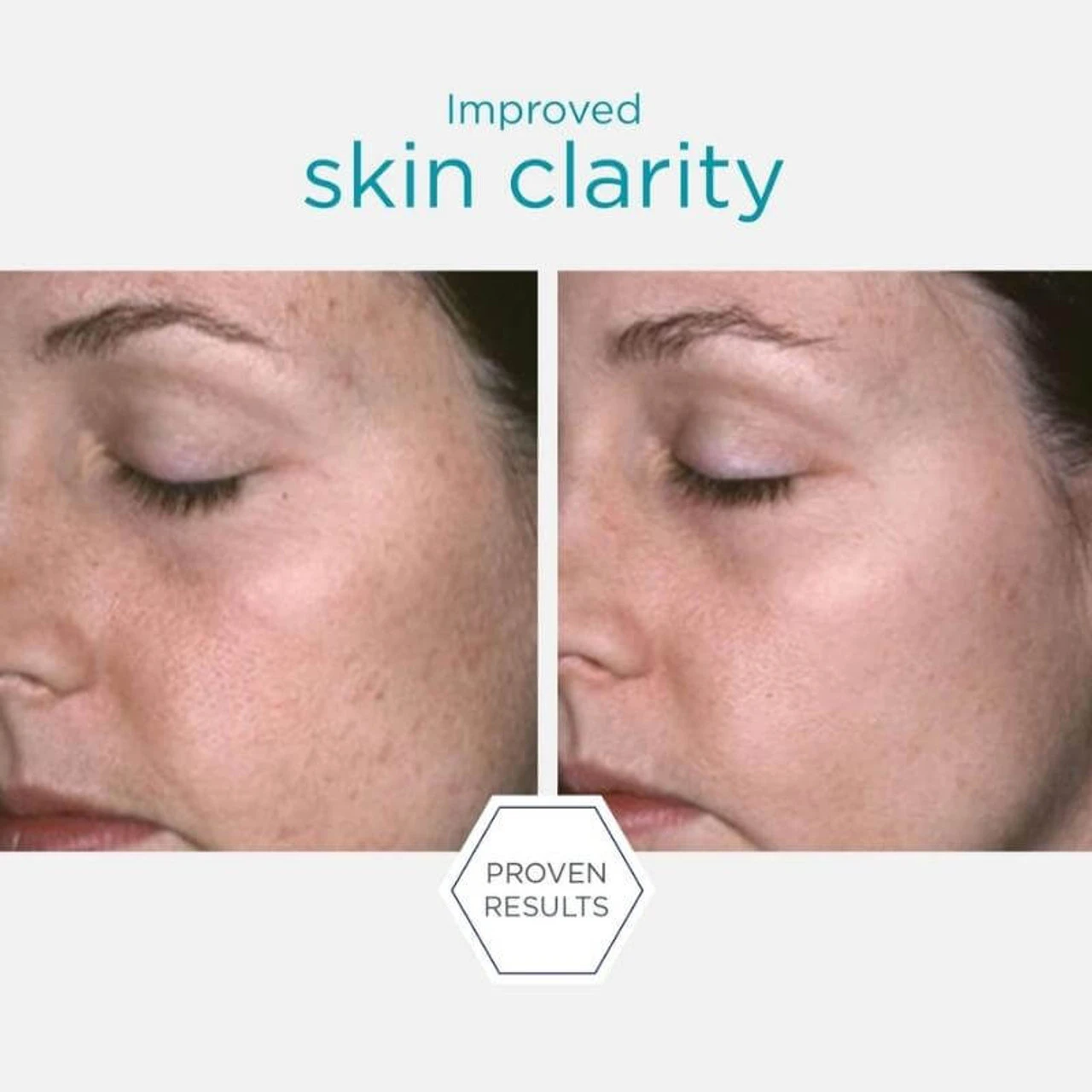 Neostrata Restore Facial Cleanser - 200ml 4 Neostrata Restore Facial Cleanser - 200ml – Image 4