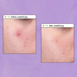 Dermalogica ClearStart Breakout Clearing Peel 30ml 9 Dermalogica ClearStart Breakout Clearing Peel 30ml -Boutique Beauté et Cosmétiques Dermalogica ClearStart Breakout Clearing Peel 30ml 2 1 69919.1664963715